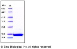 Sino Biological Recombinant Human FGF1 Protein, Quantity: Each of 1