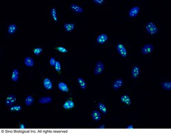Sino Biological Anti-Ki67/MKI67 Antibody, Mouse Monoclonal, Quantity: Each