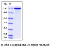 Sino Biological Human VCL / Vinculin Protein (His Tag) 50ug, Quantity: