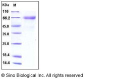 Sino Biological Recombinant Human IL-12 p35/IL12A Protein (hFc Tag), Quantity: