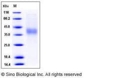 Sino Biological Human IL12A / NKSF1 Protein (His Tag) 1mg, Quantity: Each