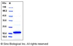 Sino Biological Recombinant Human 4EBP1 Protein (His Tag), HPLC-verified,