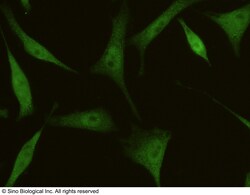 Sino Biological 4E-BP1 / EIF4EBP1 Antibody, Mouse MAb 100uL, Quantity: