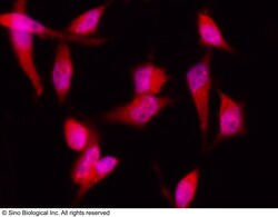 Sino Biological 4E-BP1 / EIF4EBP1 Antibody, Rabbit MAb 100uL, Quantity:
