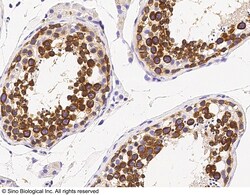Sino Biological DDX4 Antibody, Rabbit PAb, Antigen Affinity Purified 100uL,