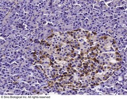 Sino Biological Anti-Chromogranin A/CHGA Antibody, Rabbit Polyclonal, Quantity: