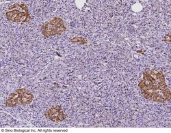 Sino Biological NSE(Gamma-enolase) Antibody, Rabbit PAb, Antigen Affinity