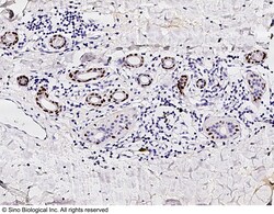 Sino Biological Anti-p63 Antibody, Rabbit Polyclonal, Quantity: Each of