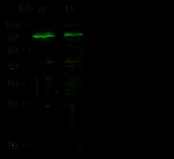 Sino Biological Anti-Androgen receptor Antibody, Rabbit Polyclonal, Quantity: