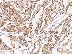 Sino Biological Anti-Desmin Antibody, Mouse Monoclonal, Quantity: Each