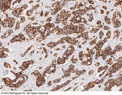 Sino Biological Anti-Cytokeratin 7/KRT7 Antibody, Mouse Monoclonal, Quantity: