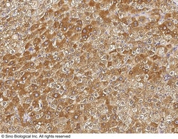 Sino Biological Anti-PIP/GCDFP 15 Antibody, Rabbit Polyclonal, Quantity:
