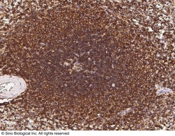 Sino Biological Anti-CD45 Antibody, Mouse Monoclonal, Quantity: Each of