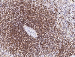 Sino Biological Recombinant Anti-CD45 Antibody, Rabbit Monoclonal, Quantity: