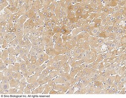 Sino Biological Anti-Chordin Antibody, Rabbit Polyclonal, Quantity: Each