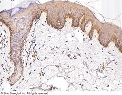 Sino Biological Anti-Integrin alpha 3 Antibody, Rabbit Polyclonal, Quantity: