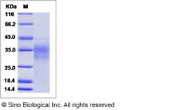 Sino Biological Recombinant Human CD30 Ligand/TNFSF8 Protein, Quantity: