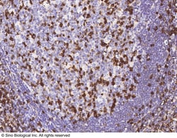Sino Biological IFITM1 Antibody, Rabbit MAb 100uL, Quantity: Each of 1