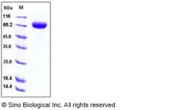 Sino Biological Recombinant Human 2B4/CD244 Protein (hFc Tag), Quantity: