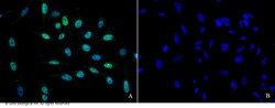 Sino Biological Anti-HNF1A Antibody, Rabbit Polyclonal, Quantity: Each