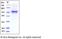 Sino Biological Human GSK3B Protein (His Tag) 50ug, Quantity: Each of 1