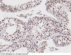 Sino Biological Lin28A Antibody, Rabbit PAb, Antigen Affinity Purified