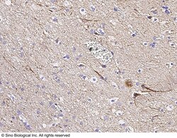 Sino Biological Anti-Neurofilament Heavy Antibody, Rabbit Polyclonal, Quantity: