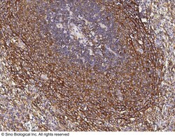 Sino Biological Recombinant Anti-CCR1 Antibody, Rabbit Monoclonal, Quantity: