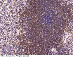 Sino Biological Anti-CCR1 Antibody, Rabbit Polyclonal, Quantity: Each of