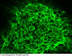 Sino Biological Anti-CCR1 Antibody, Rabbit Polyclonal, Quantity: Each of