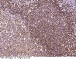 Sino Biological CD35 Antibody, Rabbit PAb, Antigen Affinity Purified 100uL,