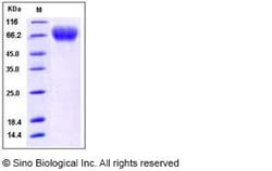 Sino Biological Recombinant Human TrkB Protein (His Tag), HPLC-verified,