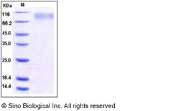 Sino Biological Recombinant Human TrkC Protein (His Tag), Quantity: Each