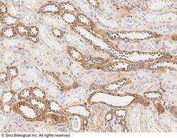 Sino Biological ADAM8 / CD156 Antibody, Rabbit PAb, Antigen Affinity Purified