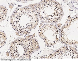 Sino Biological Anti-CD203c/ENPP-3 Antibody, Rabbit Polyclonal, Quantity: