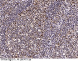 Sino Biological KIR3DL3 / CD158z Antibody, Rabbit PAb, Antigen Affinity