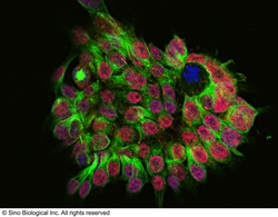 Sino Biological Anti-SALL4 Antibody, Rabbit Polyclonal, Quantity: Each