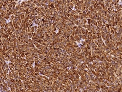 Sino Biological Recombinant Anti-S100B Antibody, Rabbit Monoclonal, Quantity: