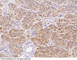 Sino Biological Anti-S100B Antibody, Rabbit Polyclonal, Quantity: Each