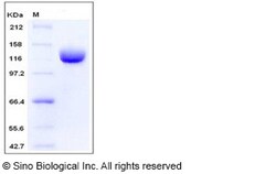 Sino Biological Human ANPEP / CD13 Protein (603 Met/Ile, His Tag) 50ug,
