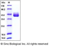 Sino Biological Recombinant Human IL-12 p40/IL12B Protein (His Tag), Quantity: