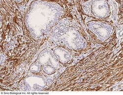Sino Biological Recombinant Anti-MYH11 Antibody, Rabbit Monoclonal, Quantity: