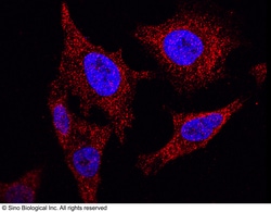 Sino Biological Anti-NANOS1 Antibody, Rabbit Polyclonal, Quantity: Each