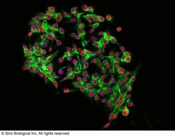 Sino Biological Anti-Nac1/NACC1 Antibody, Rabbit Polyclonal, Quantity: