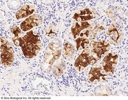 Sino Biological CFC1 Antibody, Rabbit PAb, Antigen Affinity Purified 100uL,