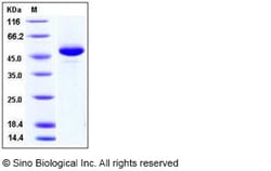Sino Biological Recombinant Human BAFF/BLyS/TNFSF13B Protein (hFc Tag),