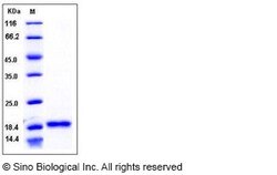Sino Biological Recombinant Human BAFF/BLyS/TNFSF13B Protein (ECD), Quantity:
