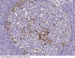 Sino Biological Anti-Integrin alpha V/ITGAV Antibody, Rabbit Polyclonal,