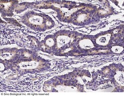 Sino Biological Anti-MAP2 Antibody, Rabbit Polyclonal, Quantity: Each of