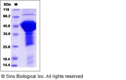 Sino Biological Recombinant Human Tau Protein (His Tag), Quantity: Each